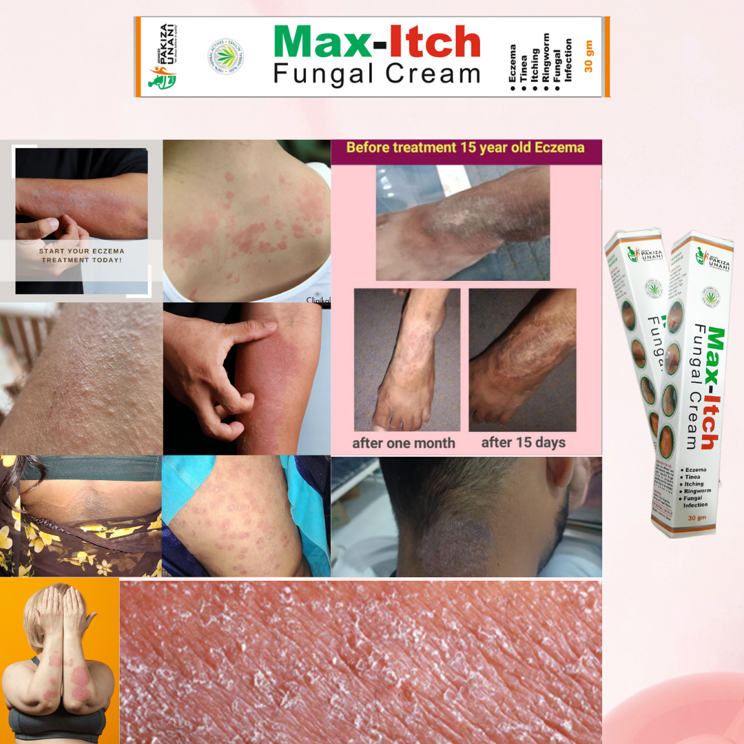 Tykhe Healthcare Max Itch Cream Pack of 2